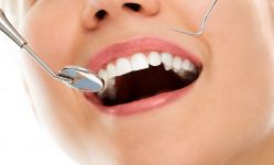 Warszawski stomatolog wyjaśnia, dlaczego regularne wizyty kontrolne są niezbędne do zachowania zdrowego uśmiechu