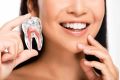 Lakowanie zębów. Na czym polega ten zabieg i czy warto go wykonywać?