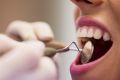 Periodontolog – kim jest i kiedy warto umówić się na wizytę u periodontologa?