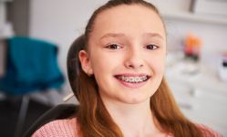 Kiedy założyć aparat ortodontyczny?