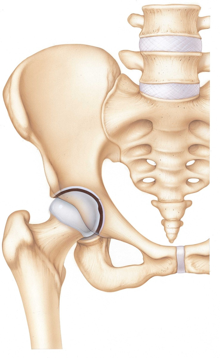 Anatomia stawu biodrowego – przekrój z zaznaczoną chrząstką stawową i obrąbkiem